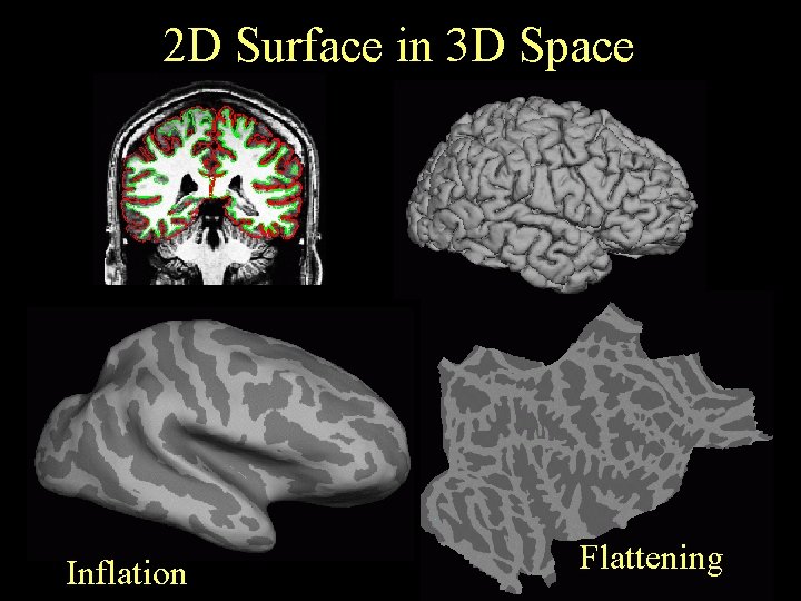 2 D Surface in 3 D Space Inflation Flattening 