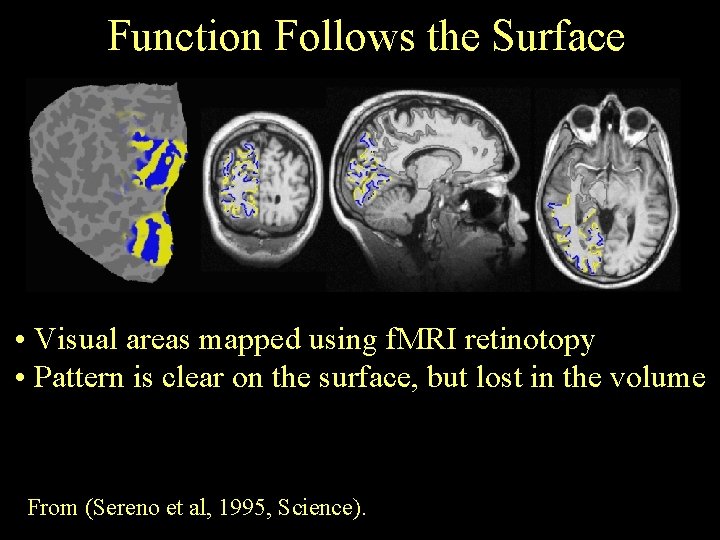 Function Follows the Surface • Visual areas mapped using f. MRI retinotopy • Pattern