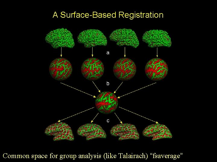 A Surface-Based Registration Common space for group analysis (like Talairach) “fsaverage” 