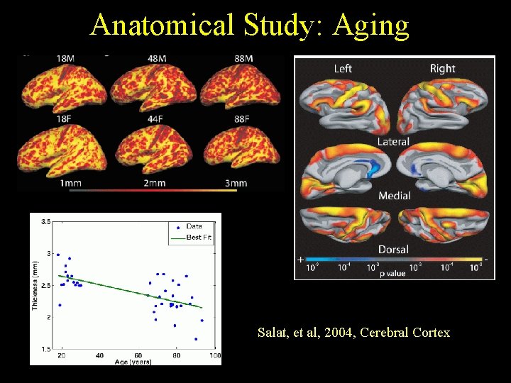 Anatomical Study: Aging Salat, et al, 2004, Cerebral Cortex 