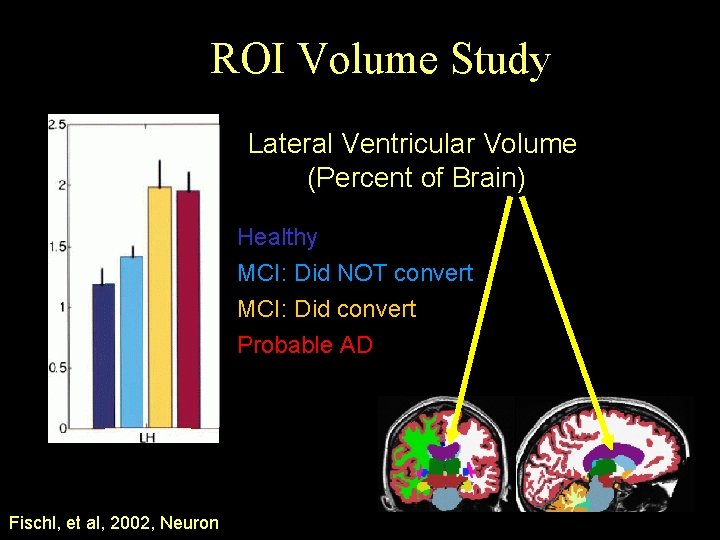 ROI Volume Study Lateral Ventricular Volume (Percent of Brain) Healthy MCI: Did NOT convert