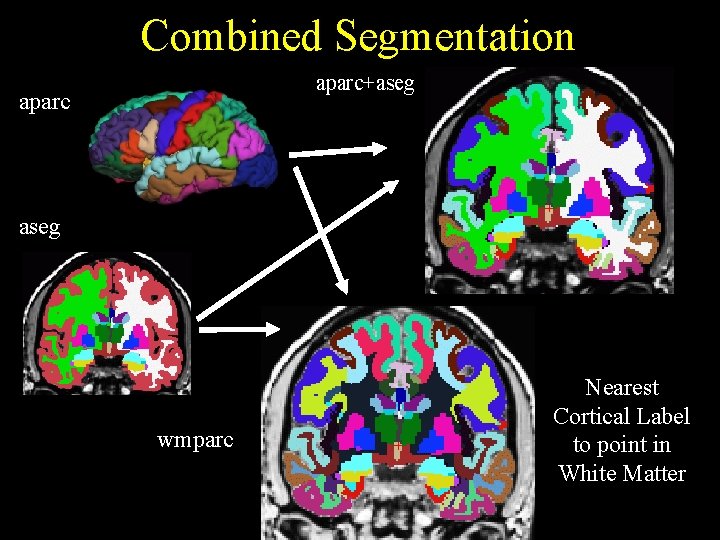 Combined Segmentation aparc+aseg aparc aseg wmparc Nearest Cortical Label to point in White Matter