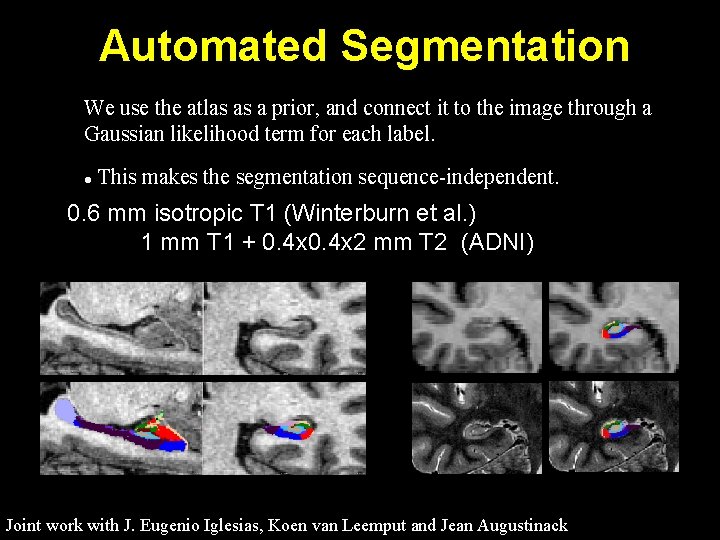 Automated Segmentation We use the atlas as a prior, and connect it to the
