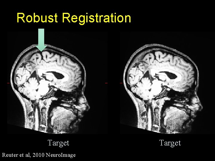 Robust Registration Target Reuter et al, 2010 Neuro. Image Target 