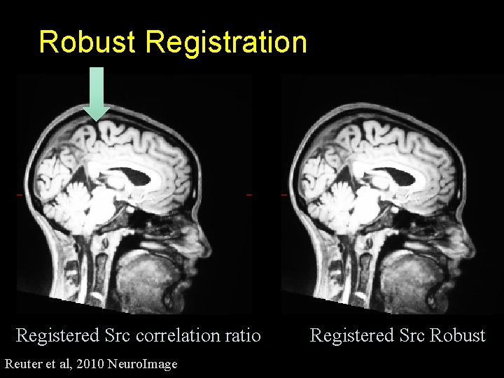 Robust Registration Registered Src correlation ratio Reuter et al, 2010 Neuro. Image Registered Src