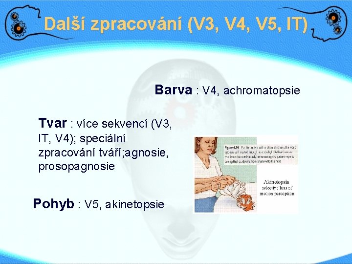 Další zpracování (V 3, V 4, V 5, IT) Barva : V 4, achromatopsie