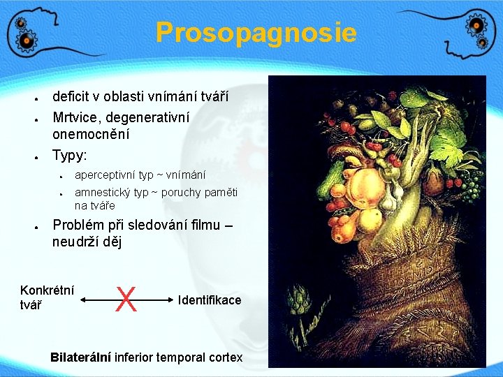 Prosopagnosie ● ● ● deficit v oblasti vnímání tváří Mrtvice, degenerativní onemocnění Typy: ●