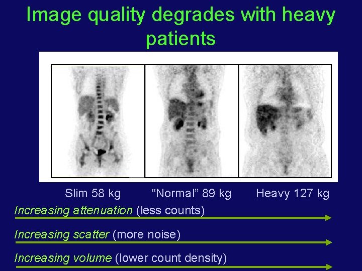 Image quality degrades with heavy patients Slim 58 kg “Normal” 89 kg Increasing attenuation