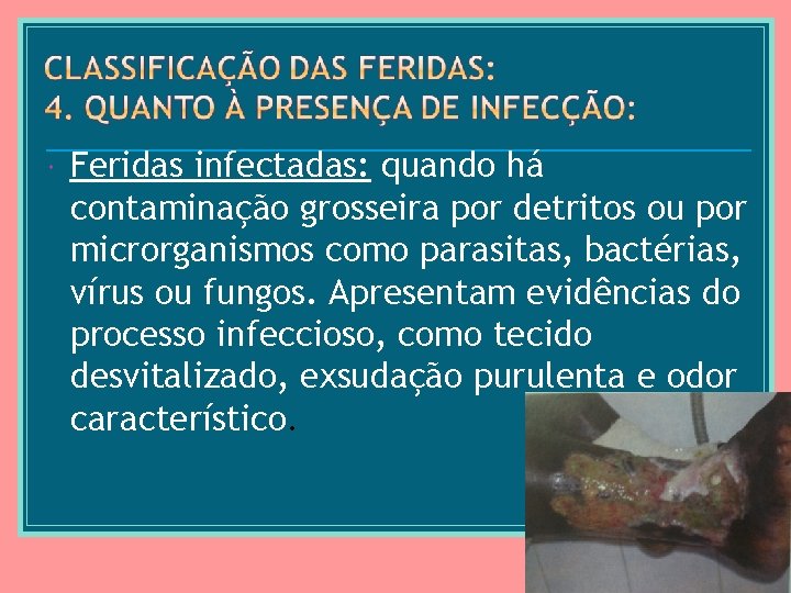  Feridas infectadas: quando há contaminação grosseira por detritos ou por microrganismos como parasitas,