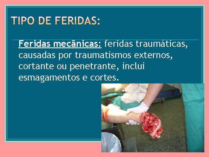  Feridas mecânicas: feridas traumáticas, causadas por traumatismos externos, cortante ou penetrante, inclui esmagamentos