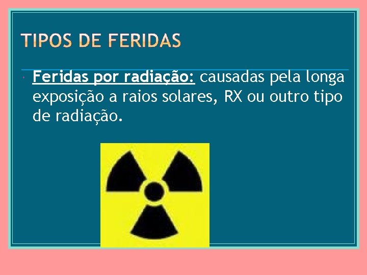  Feridas por radiação: causadas pela longa exposição a raios solares, RX ou outro