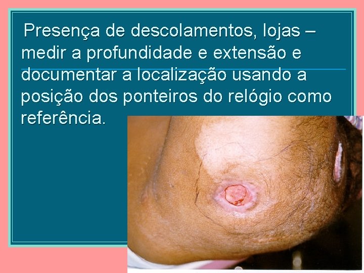 Presença de descolamentos, lojas – medir a profundidade e extensão e documentar a localização