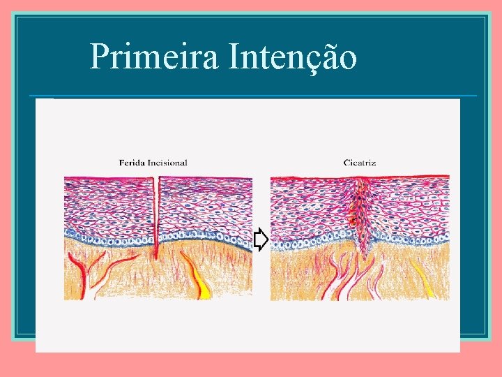 Primeira Intenção 