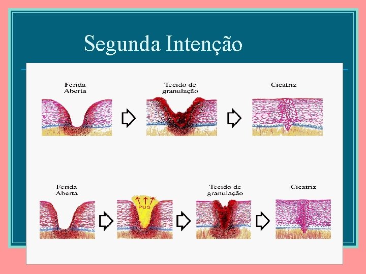 Segunda Intenção 