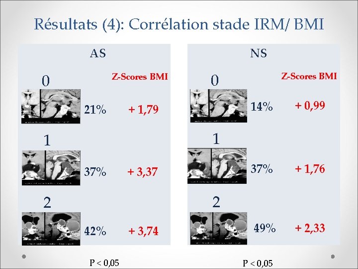 Résultats (4): Corrélation stade IRM/ BMI AS 0 NS Z-Scores BMI 21% 0 +