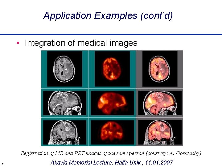 Application Examples (cont’d) • Integration of medical images Registration of MR and PET images