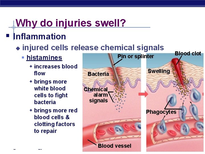 Why do injuries swell? § Inflammation u injured cells release chemical signals Pin or