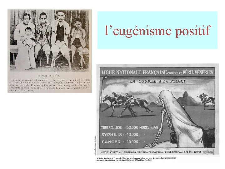 l’eugénisme positif l’eugénisme positif