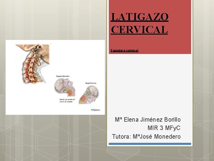 LATIGAZO CERVICAL Esguince cervical Mª Elena Jiménez Borillo MIR 3 MFy. C Tutora: MªJosé