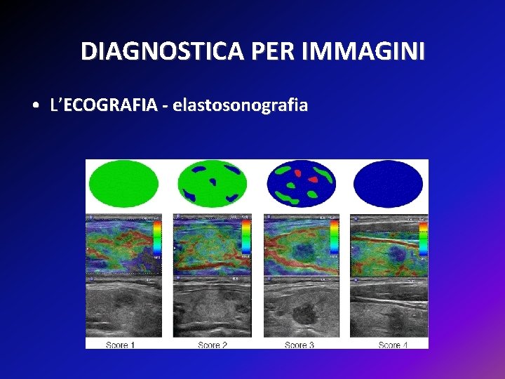 DIAGNOSTICA PER IMMAGINI • L’ECOGRAFIA - elastosonografia 