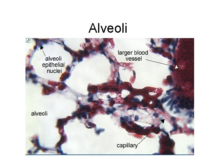 Alveoli 