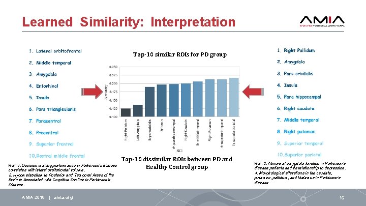 Learned Similarity: Interpretation Top-10 similar ROIs for PD group Ref: 1. Decision-making performance in