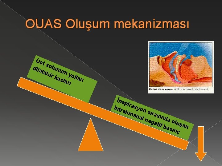 OUAS Oluşum mekanizması Üst sol u tatö num y o r ka sla lları