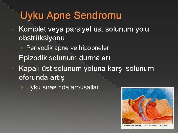 Uyku Apne Sendromu Komplet veya parsiyel üst solunum yolu obstrüksiyonu › Periyodik apne ve