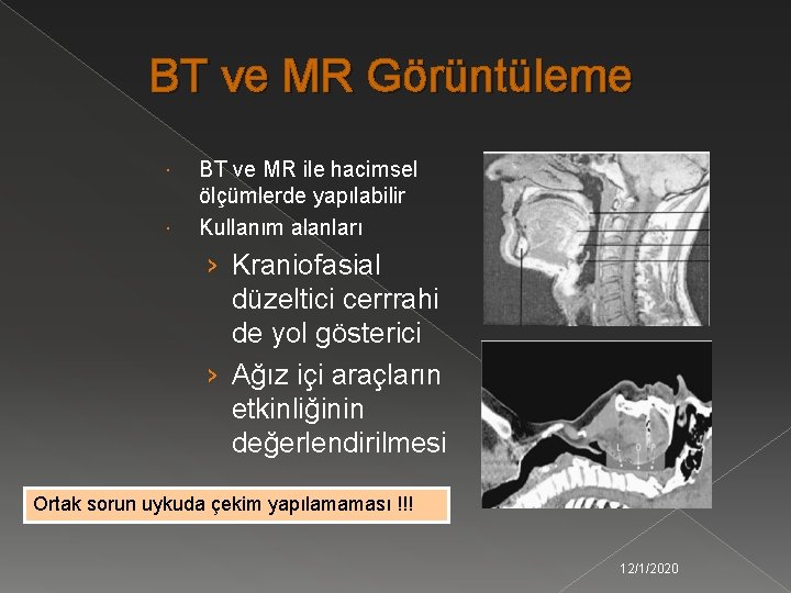 BT ve MR Görüntüleme BT ve MR ile hacimsel ölçümlerde yapılabilir Kullanım alanları ›