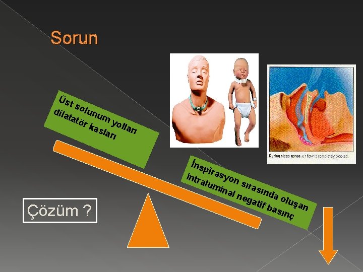 Sorun Üst sol u tatö num y o r ka sla lları rı dila