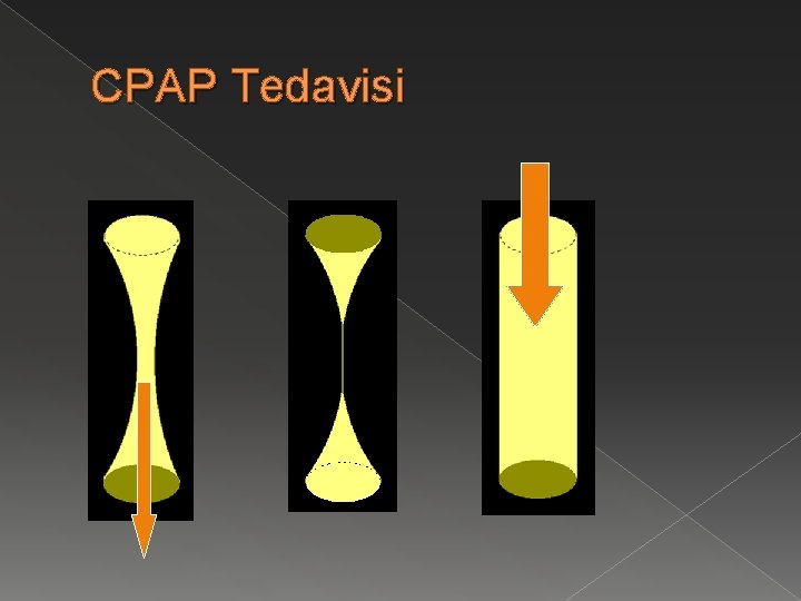 CPAP Tedavisi 
