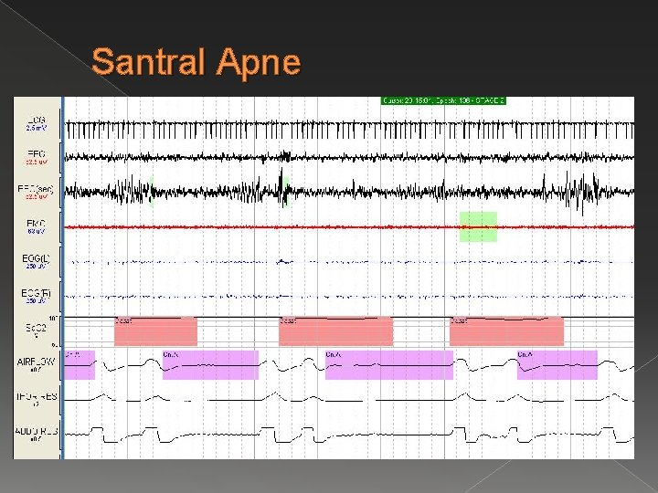Santral Apne 