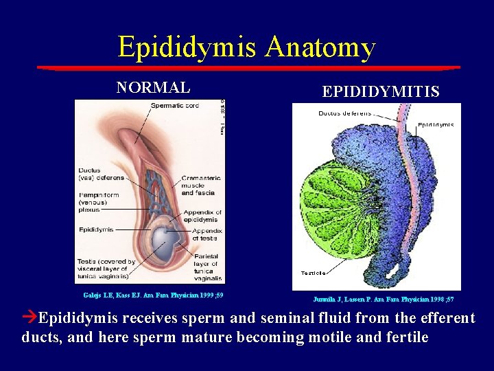 Epididymis Anatomy NORMAL Galejs LE, Kass EJ. Am Fam Physician 1999; 59 EPIDIDYMITIS Junnila