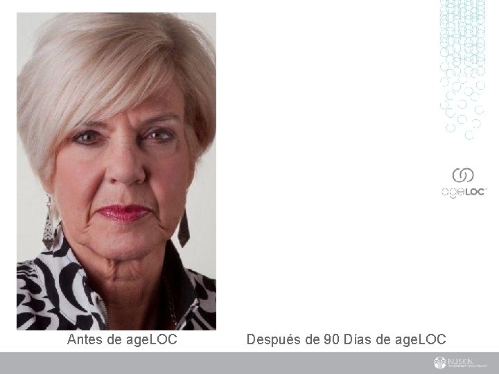 Antes de age. LOC Después de 90 Días de age. LOC 