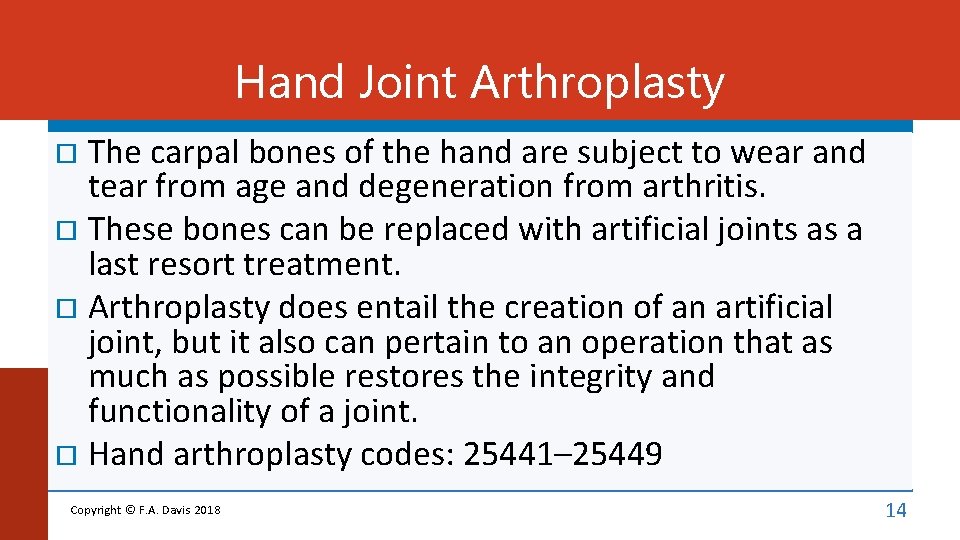 Hand Joint Arthroplasty The carpal bones of the hand are subject to wear and