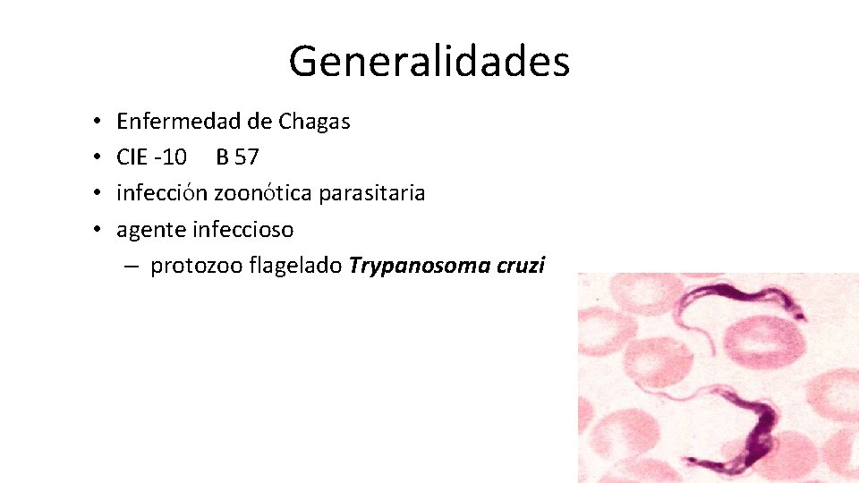 Generalidades • • Enfermedad de Chagas CIE -10 B 57 infección zoonótica parasitaria agente