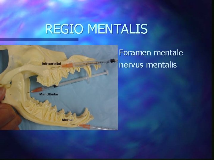 REGIO MENTALIS n n Foramen mentale nervus mentalis 