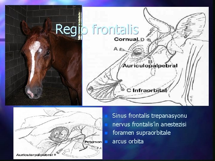 Regio frontalis n n Sinus frontalis trepanasyonu nervus frontalis’in anestezisi foramen supraorbitale arcus orbita