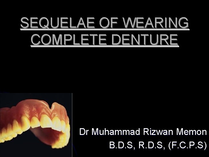 SEQUELAE OF WEARING COMPLETE DENTURE Dr Muhammad Rizwan Memon B. D. S, R. D.