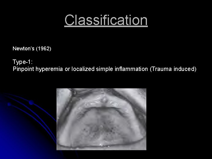 Classification Newton’s (1962) Type-1: Pinpoint hyperemia or localized simple inflammation (Trauma induced) 