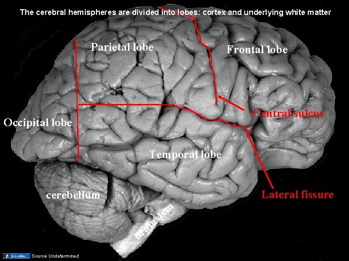 The cerebral hemispheres are divided into lobes: cortex and underlying white matter Parietal lobe