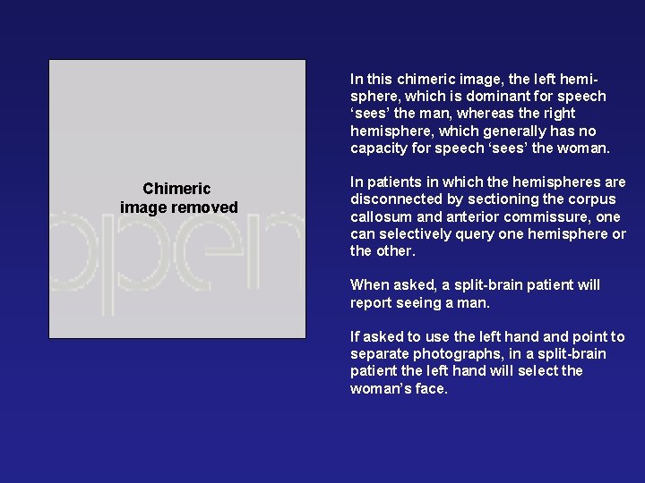 In this chimeric image, the left hemisphere, which is dominant for speech ‘sees’ the