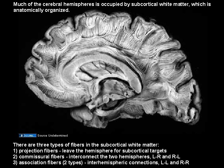 Much of the cerebral hemispheres is occupied by subcortical white matter, which is anatomically