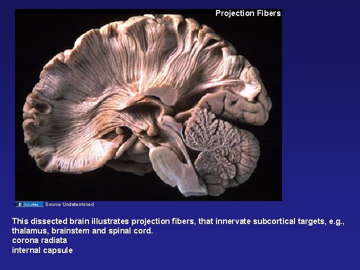 Projection Fibers Source Undetermined This dissected brain illustrates projection fibers, that innervate subcortical targets,
