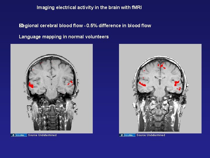 Imaging electrical activity in the brain with f. MRI Regional cerebral blood flow -