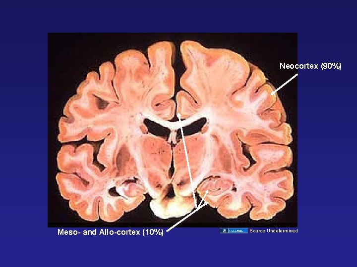 Neocortex (90%) Meso- and Allo-cortex (10%) Source Undetermined 