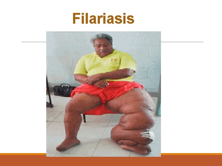 Filariasis 