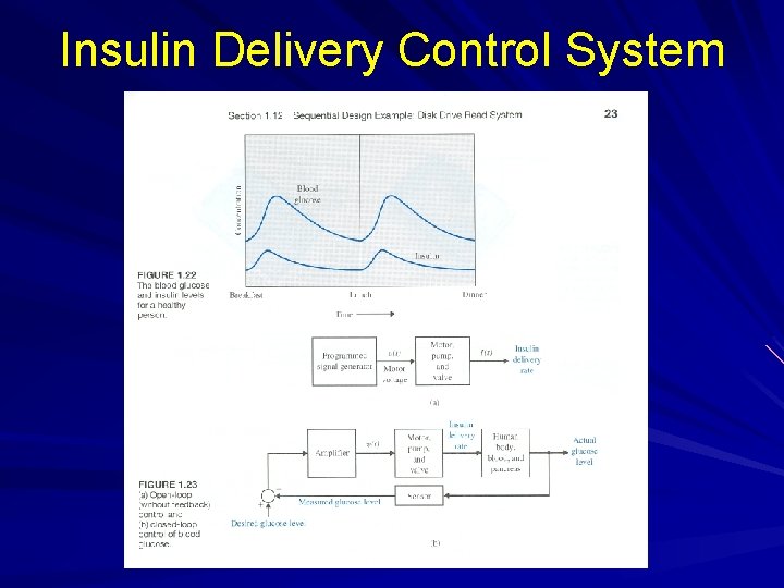 Insulin Delivery Control System 