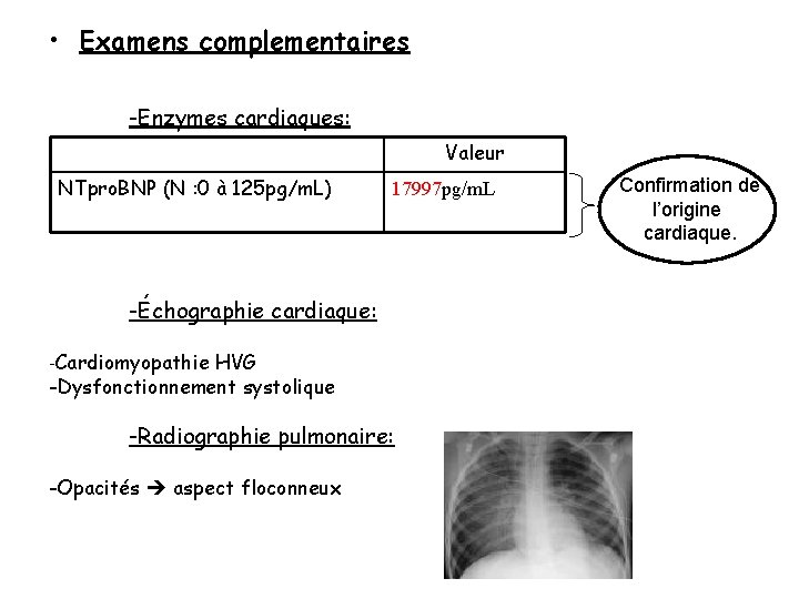 • Examens complementaires -Enzymes cardiaques: Valeur NTpro. BNP (N : 0 à 125 • Examens complementaires -Enzymes cardiaques: Valeur NTpro. BNP (N : 0 à 125