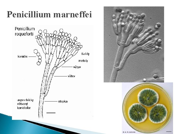 Penicillium marneffei 